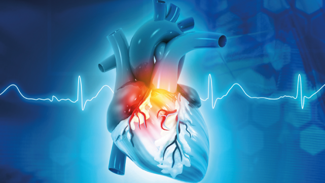 ELECTROCARDIOGRAFÍA